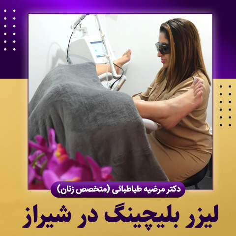 لیزر بلیچینگ در شیراز