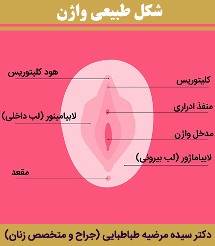 شکل-طبیعی-واژن