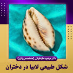 شکل-طبیعی-لابیا-در-دختران