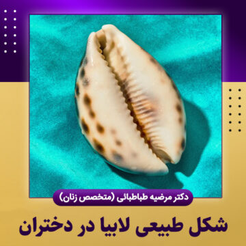 شکل-طبیعی-لابیا-در-دختران