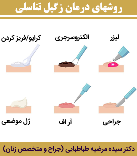 روشهای-درمان-زگیل-تناسلی