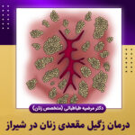 درمان-زگیل-مقعدی-زنان-در-شیراز