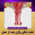 علت-تنگی-واژن-بعد-از-عمل