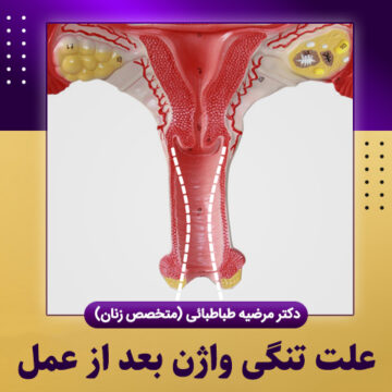 علت-تنگی-واژن-بعد-از-عمل