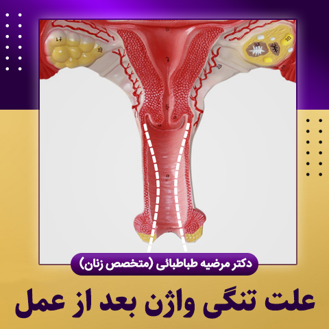 علت-تنگی-واژن-بعد-از-عمل
